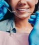 $15.000 Descuento en Uno Salud Dental